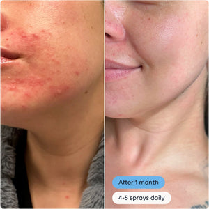 Magic Molecule Solution Spray - 2oz